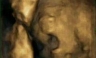 Imágenes increíbles muestran a un bebé bostezando en el útero [VIDEO]