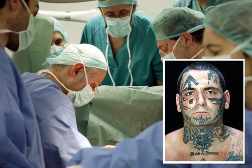 Ex nazi se somete a 25 operaciones para borrarse tatuajes del rostro