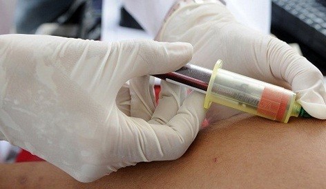 Científicos cubanos anuncian que realizarán pruebas de vacunas para el VIH en humanos