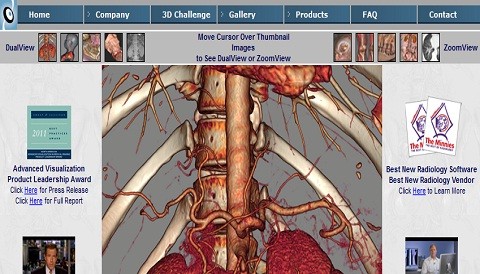 Fovia trae visualización avanzada a la sala de operaciones vía iPad