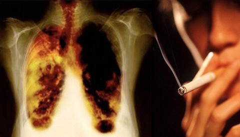 Unos 10 mil peruanos mueren cada año por enfermedades causadas por humo del cigarro