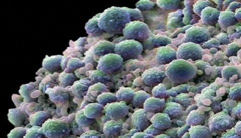 Desarrollan fármaco que frena células cancerígenas y regenera células nerviosas Desarrollan fármaco que frena células cancerígenas y regenera células nerviosas