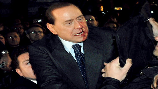 Silvio Berlusconi sufrió un accidente casero