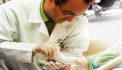 Para Walter Navarro, médico de quemados