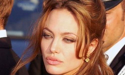 Angelina Jolie necesitaría trasplante de hígado con urgencia