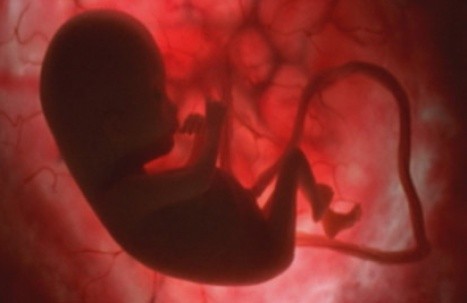 Canadá: piden ocultar el sexo del feto para evitar abortos de niñas