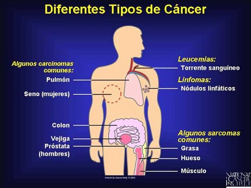 Para 2030 habrá 22 millones de enfermos de cáncer en el mundo