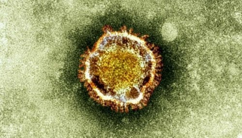 Coronavirus infecta a cuatro más en Arabia Saudita