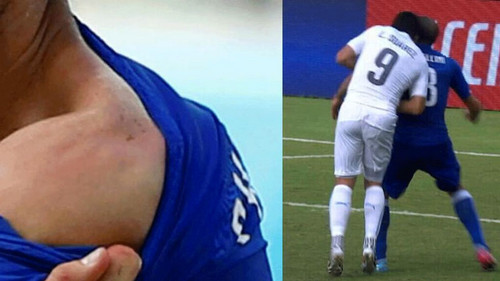 Luis Suarez bajo la lupa disciplinaria de la FIFA por el mordisco que le habría propinado a Chiellini