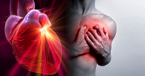 28 de cada 100 peruanos sufren alguna enfermedad cardiaca