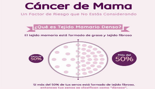 Tejido mamario denso es factor de riesgo para cáncer de mama