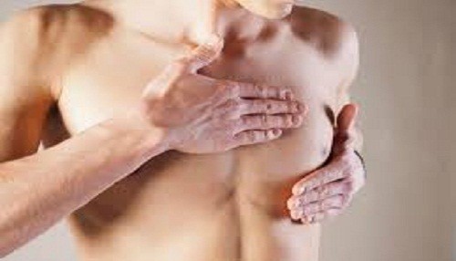 EsSalud: Bulto debajo de la piel o tetilla podría ser cáncer de mama en varones