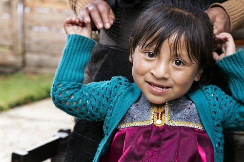 Operación sonrisa sigue cambiando vidas, una sonrisa a la vez