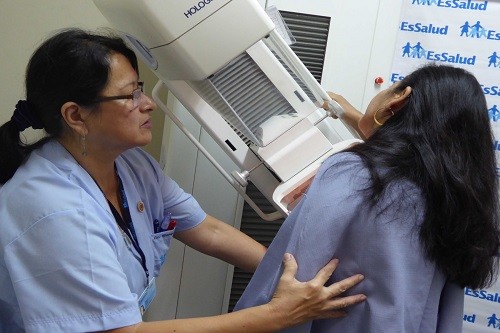 EsSalud fortalece detección precoz de cáncer de mama y cuello uterino