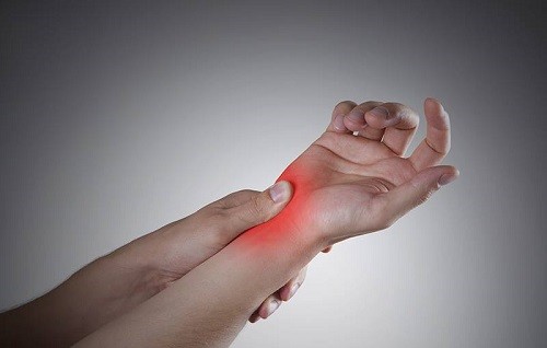 Artritis Reumatoide (Ar): Casos más frecuentes se inician en mujeres de 25 a 35 años