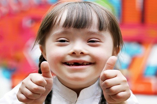 Día Mundial del Síndrome de Down: Consejos para el cuidado adecuado de los niños