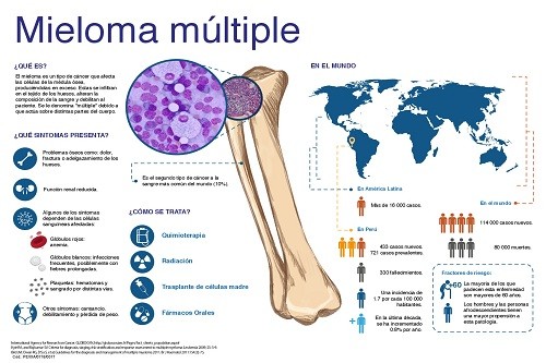 Mieloma múltiple: un cáncer más frecuente a partir de los 60 años
