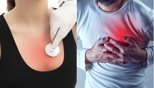 Síntomas del infarto al corazón son diferentes en hombres y mujeres