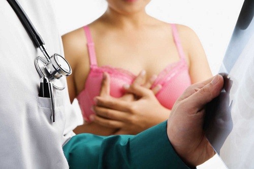 7 preguntas que debes saber sobre el cáncer de mamas