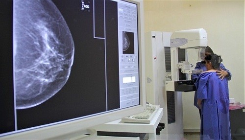Más de 40 000 casos nuevos de cáncer se registraron en el Perú
