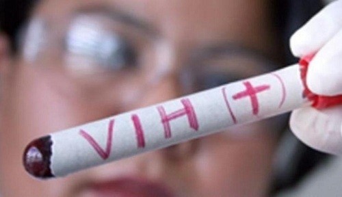 Londres: segundo paciente en casi 12 años parece haberse curado de VIH