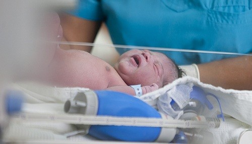 Parto por cesárea incrementa la posibilidad de tener bebés con anemia