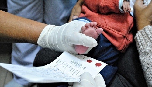 Hospital Cayetano Heredia descartó enfermedades congénitas en más de 15 mil recién nacidos