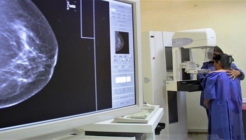 Minsa fortalece el sistema de telemamografías para luchar contra el cáncer de mama en el país