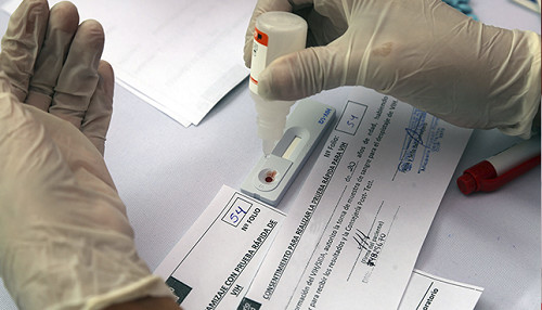 En el Perú el 81% de las personas viviendo con VIH reciben tratamiento antirretroviral