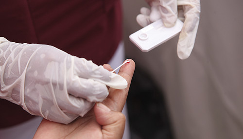 Minsa realizó cerca de dos millones de tamizajes gratuitos de VIH en lo que va de este año