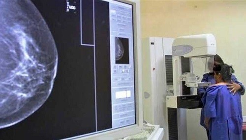 El cáncer de mama tiene un 90% de probabilidades de curación si se detecta a tiempo