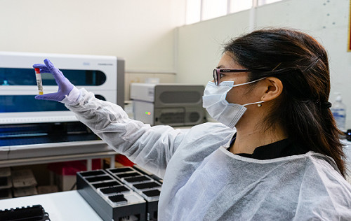 EsSalud: Hepatitis B es más contagiosa que VIH - SIDA