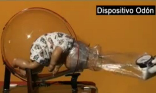 Video: la nueva forma de parto que evita las cesáreas
