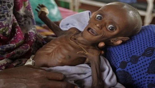 Impactante imagen del bebe símbolo de Africa