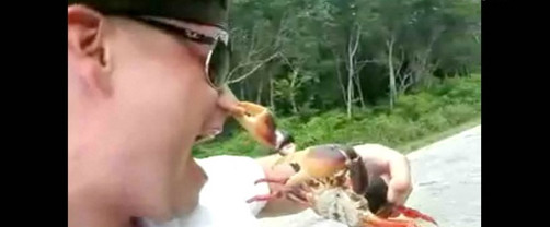 Video: hombre es mordido en la nariz por un cangrejo