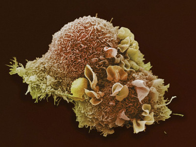 Biólogos afirman haber encontrado la cura del cáncer