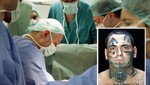 Ex nazi se somete a 25 operaciones para borrarse tatuajes del rostro
