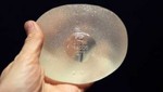 Argentina: Víctimas de implantes de la marca PIP piden fuertes indemnizaciones