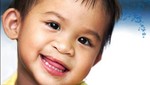 33 niños con labio leporino serán operados de forma gratuita