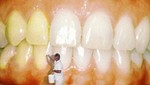 La Odontología Biológica en la historia
