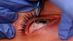 Crece índice de la enfermedad ocular diabética en México