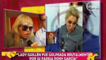 [VIDEO] Una vez más: Bailarina Lady Guillén fue golpeada salvajemente por su pareja