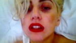[FOTOS]: Así quedó Lady Gaga luego de un accidente en el escenario