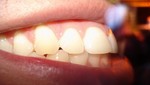 Los dientes: Agentes secretos de los dolores corporales