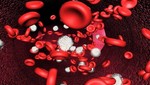 La anemia no es una enfermedad