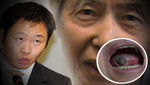 Kenji Fujimori mostró fotografía de lesión en la lengua de Alberto Fujimori