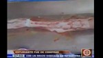 Estuandiante de medicina habría comprado un brazo en la Morgue Central de Lima [VIDEO]