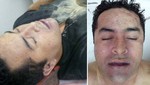 México: El Lazca murió de seis disparos [VIDEO]