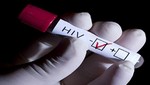 Crean prueba para VIH diez veces más sensible