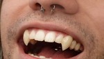 ¿Qué pasa si alguién se afila los dientes como los de un Vampiro? [VIDEO]